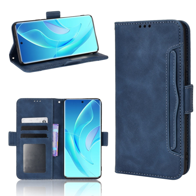 Skin Feel Calf Pattern Leather Phone Case, For Cricket Dream 5G / AT&T Radiant Max 5, For OPPO Find N, For OPPO Find X5 Pro, For OPPO Find X5, For OPPO Realme 9 Pro, For OPPO Realme C35, For TCL 30 SE / 30 E / 306 / Sharp Aquos V6                      ...