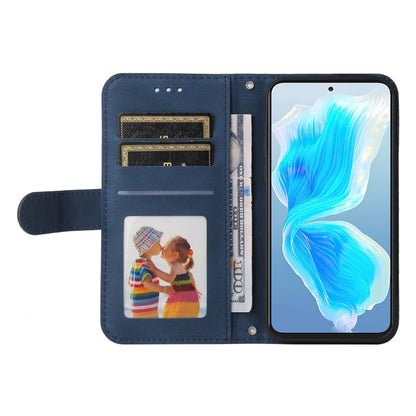 Skin Feel Life Tree Metal Button Leather Phone Case, For Tecno Camon 18 Premier, For Tecno Camon 18 / 18 Pro, For Infinix Hot 11s, For Infinix Hot 11s NFC, For Infinix Hot 11, For Infinix Smart 6, For Infinix Note 11 Pro / 11S / X697                   ...