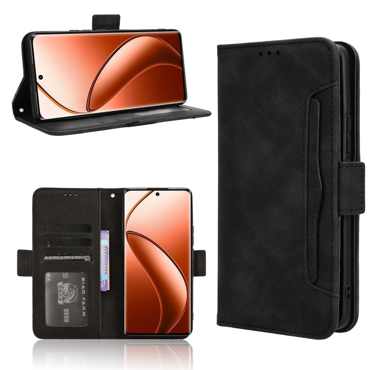 Skin Feel Calf Texture Card Slots Leather Phone Case, For Realme GT 7 5G, For Realme 14x 5G Malaysia / V70, For Realme 14 5G, For Realme P3 Ultra 5G, For Realme P3 5G / Neo7x 5G, For Realme 14 Pro Lite 5G, For Realme P3 Pro 5G, For Realme 14 Pro+ 5G   ...