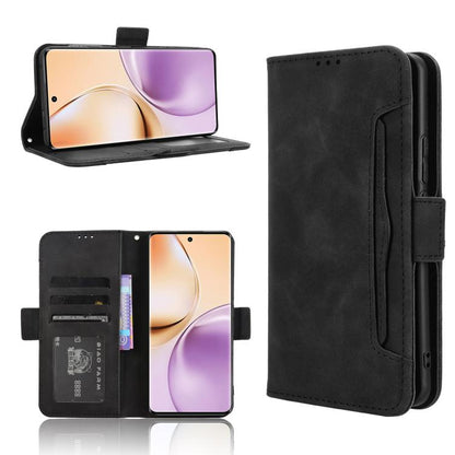 Skin Feel Calf Texture Card Slots Leather Phone Case, For Realme GT 7 5G, For Realme 14x 5G Malaysia / V70, For Realme 14 5G, For Realme P3 Ultra 5G, For Realme P3 5G / Neo7x 5G, For Realme 14 Pro Lite 5G, For Realme P3 Pro 5G, For Realme 14 Pro+ 5G   ...