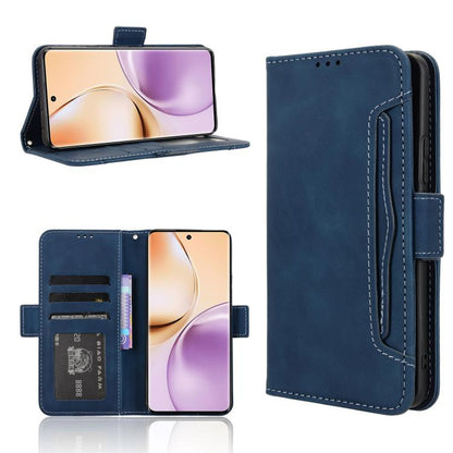 Skin Feel Calf Texture Card Slots Leather Phone Case, For Realme GT 7 5G, For Realme 14x 5G Malaysia / V70, For Realme 14 5G, For Realme P3 Ultra 5G, For Realme P3 5G / Neo7x 5G, For Realme 14 Pro Lite 5G, For Realme P3 Pro 5G, For Realme 14 Pro+ 5G   ...