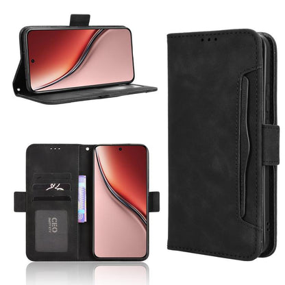 Skin Feel Calf Texture Card Slots Leather Phone Case, For Realme GT 7 5G, For Realme 14x 5G Malaysia / V70, For Realme 14 5G, For Realme P3 Ultra 5G, For Realme P3 5G / Neo7x 5G, For Realme 14 Pro Lite 5G, For Realme P3 Pro 5G, For Realme 14 Pro+ 5G   ...