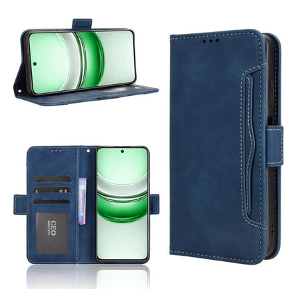 Skin Feel Calf Texture Card Slots Leather Phone Case, For Realme GT 7 5G, For Realme 14x 5G Malaysia / V70, For Realme 14 5G, For Realme P3 Ultra 5G, For Realme P3 5G / Neo7x 5G, For Realme 14 Pro Lite 5G, For Realme P3 Pro 5G, For Realme 14 Pro+ 5G   ...