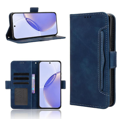 Skin Feel Calf Texture Card Slots Leather Phone Case, For Realme 16T 5G, For Realme C100i 4G / C100x 4G, For Realme C100 4G, For Realme C83 5G / P4 Lite 5G, For Realme P4 Power 5G, For Realme Note 80 4G, For Realme 16 5G, For Realme 16 Pro+ 5G         ...