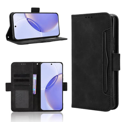 Skin Feel Calf Texture Card Slots Leather Phone Case, For Realme 16T 5G, For Realme C100i 4G / C100x 4G, For Realme C100 4G, For Realme C83 5G / P4 Lite 5G, For Realme P4 Power 5G, For Realme Note 80 4G, For Realme 16 5G, For Realme 16 Pro+ 5G         ...