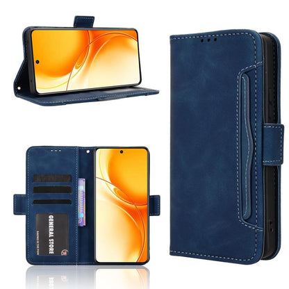 Skin Feel Calf Texture Card Slots Leather Phone Case, For Realme 16T 5G, For Realme C100i 4G / C100x 4G, For Realme C100 4G, For Realme C83 5G / P4 Lite 5G, For Realme P4 Power 5G, For Realme Note 80 4G, For Realme 16 5G, For Realme 16 Pro+ 5G         ...