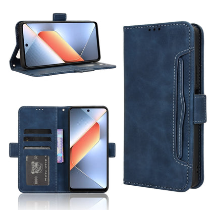 Skin Feel Calf Texture Card Slots Leather Phone Case, For Tecno Camon 40 4G, For Tecno Camon 30S 4G / 30S Pro 4G, For Tecno Pova 6 Neo 5G / Spark 30 5G, For Tecno Spark 30 Pro 4G, For Tecno Spark 30 4G, For Tecno Spark Go 1 / Pop 9 / Spark Go 2025     ...