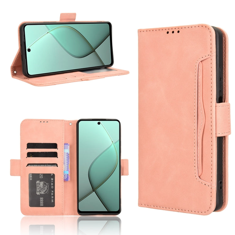 Skin Feel Calf Texture Card Slots Leather Phone Case, For Tecno Camon 40 4G, For Tecno Camon 30S 4G / 30S Pro 4G, For Tecno Pova 6 Neo 5G / Spark 30 5G, For Tecno Spark 30 Pro 4G, For Tecno Spark 30 4G, For Tecno Spark Go 1 / Pop 9 / Spark Go 2025     ...