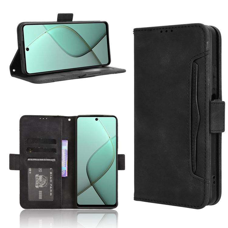 Skin Feel Calf Texture Card Slots Leather Phone Case, For Tecno Camon 40 4G, For Tecno Camon 30S 4G / 30S Pro 4G, For Tecno Pova 6 Neo 5G / Spark 30 5G, For Tecno Spark 30 Pro 4G, For Tecno Spark 30 4G, For Tecno Spark Go 1 / Pop 9 / Spark Go 2025     ...