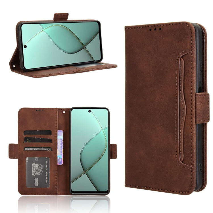 Skin Feel Calf Texture Card Slots Leather Phone Case, For Tecno Camon 40 4G, For Tecno Camon 30S 4G / 30S Pro 4G, For Tecno Pova 6 Neo 5G / Spark 30 5G, For Tecno Spark 30 Pro 4G, For Tecno Spark 30 4G, For Tecno Spark Go 1 / Pop 9 / Spark Go 2025     ...
