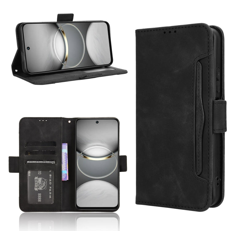 Skin Feel Calf Texture Card Slots Leather Phone Case, For Tecno Camon 40 4G, For Tecno Camon 30S 4G / 30S Pro 4G, For Tecno Pova 6 Neo 5G / Spark 30 5G, For Tecno Spark 30 Pro 4G, For Tecno Spark 30 4G, For Tecno Spark Go 1 / Pop 9 / Spark Go 2025     ...