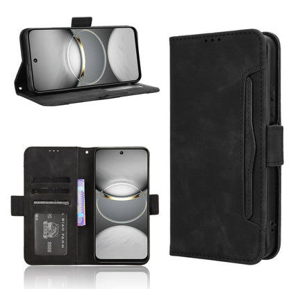 Skin Feel Calf Texture Card Slots Leather Phone Case, For Tecno Camon 40 4G, For Tecno Camon 30S 4G / 30S Pro 4G, For Tecno Pova 6 Neo 5G / Spark 30 5G, For Tecno Spark 30 Pro 4G, For Tecno Spark 30 4G, For Tecno Spark Go 1 / Pop 9 / Spark Go 2025     ...