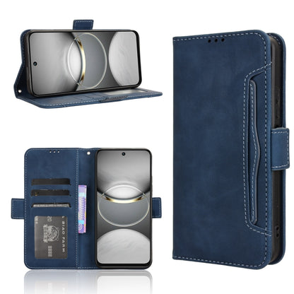 Skin Feel Calf Texture Card Slots Leather Phone Case, For Tecno Camon 40 4G, For Tecno Camon 30S 4G / 30S Pro 4G, For Tecno Pova 6 Neo 5G / Spark 30 5G, For Tecno Spark 30 Pro 4G, For Tecno Spark 30 4G, For Tecno Spark Go 1 / Pop 9 / Spark Go 2025     ...