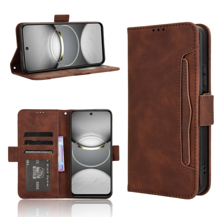 Skin Feel Calf Texture Card Slots Leather Phone Case, For Tecno Camon 40 4G, For Tecno Camon 30S 4G / 30S Pro 4G, For Tecno Pova 6 Neo 5G / Spark 30 5G, For Tecno Spark 30 Pro 4G, For Tecno Spark 30 4G, For Tecno Spark Go 1 / Pop 9 / Spark Go 2025     ...