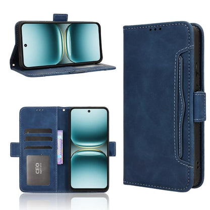 Skin Feel Calf Texture Card Slots Leather Phone Case, For Tecno Spark 50 5G, For Tecno Pova Curve 2 5G, For Tecno Spark 50 4G, For Tecno Camon 50 Pro 4G, For Tecno Camon 50 4G, For Tenco Spark Go 3, For Tecno Spark Slim, For Tecno Spark 40C            ...