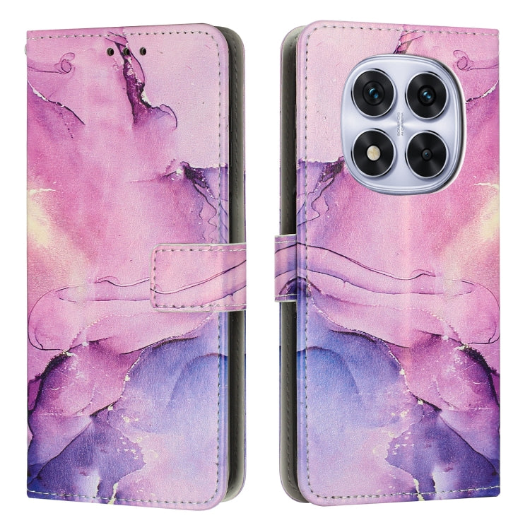 Painted Marble Pattern Leather Phone Case, For Redmi A5 4G 171.7mm / Poco C71, For Redmi K80 / K80 Pro, For Redmi 14C 4G / A3 Pro, For Redmi Note 14 5G Global, For Redmi Note 14 Pro 5G Global, For Redmi K70 Pro / K70, For Redmi Note 13 Pro 4G����������...