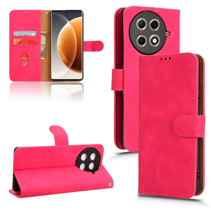 Skin Feel Magnetic Flip Leather Phone Case, For Tecno Spark Go 2025 / Spark Go 1, For Tecno Pop 9, For Tecno Spark Go 5G, For Tecno Camon 30S Pro, For Tecno Pova 6 Neo, For Tecno Camon 30 4G, For Tecno Spark 20 Pro, For Tecno Spark 20, For Tecno Pop 8 ...