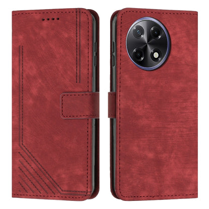Skin Feel Stripe Pattern Leather Phone Case with Lanyard, For Tecno Camon 40 Pro 5G, For Tecno Spark 30C 5G / Pop 9 5G, For Tecno Camon 30S, For Tecno Spark 30 Pro, For Tecno Spark 30 5G, For Tecno Spark 30 4G, For Tecno Spark Go 5G 2025 Global        ...
