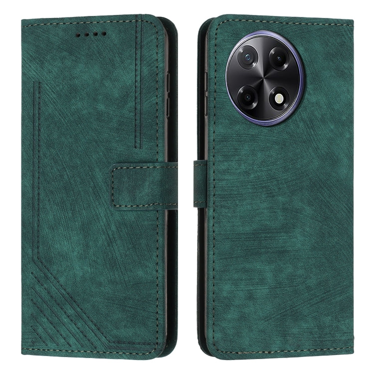Skin Feel Stripe Pattern Leather Phone Case with Lanyard, For Tecno Camon 40 Pro 5G, For Tecno Spark 30C 5G / Pop 9 5G, For Tecno Camon 30S, For Tecno Spark 30 Pro, For Tecno Spark 30 5G, For Tecno Spark 30 4G, For Tecno Spark Go 5G 2025 Global        ...
