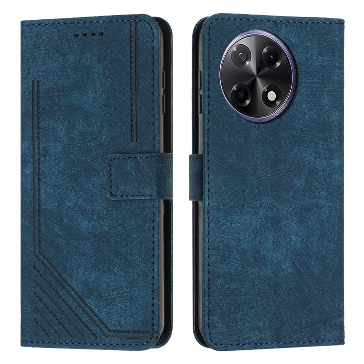 Skin Feel Stripe Pattern Leather Phone Case with Lanyard, For Tecno Camon 40 Pro 5G, For Tecno Spark 30C 5G / Pop 9 5G, For Tecno Camon 30S, For Tecno Spark 30 Pro, For Tecno Spark 30 5G, For Tecno Spark 30 4G, For Tecno Spark Go 5G 2025 Global        ...