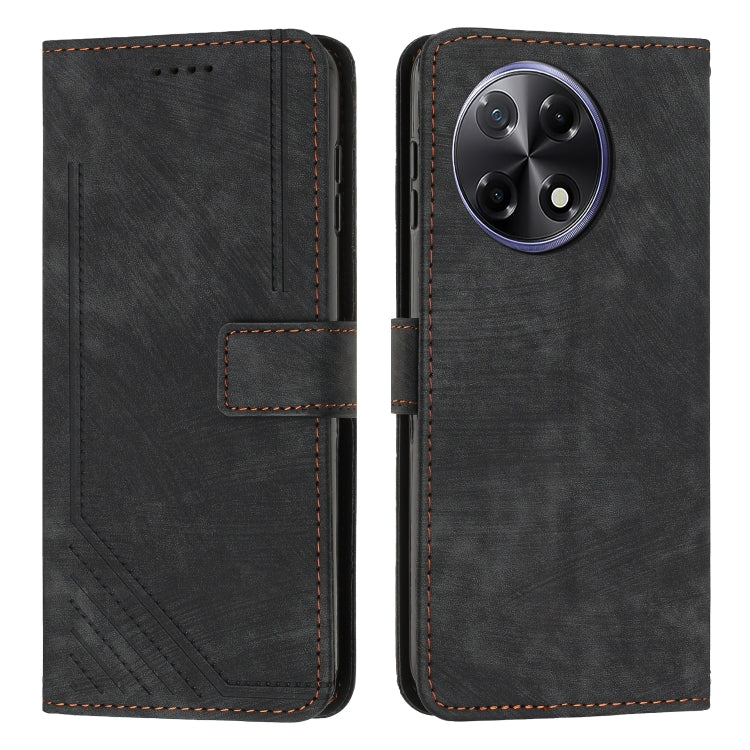 Skin Feel Stripe Pattern Leather Phone Case with Lanyard, For Tecno Camon 40 Pro 5G, For Tecno Spark 30C 5G / Pop 9 5G, For Tecno Camon 30S, For Tecno Spark 30 Pro, For Tecno Spark 30 5G, For Tecno Spark 30 4G, For Tecno Spark Go 5G 2025 Global        ...