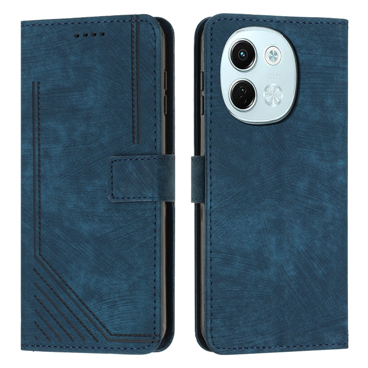 Skin Feel Stripe Pattern Leather Phone Case with Lanyard, For Tecno Camon 40 Pro 5G, For Tecno Spark 30C 5G / Pop 9 5G, For Tecno Camon 30S, For Tecno Spark 30 Pro, For Tecno Spark 30 5G, For Tecno Spark 30 4G, For Tecno Spark Go 5G 2025 Global        ...