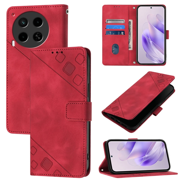 Skin Feel Embossed Leather Phone Case, For Tecno Camon 50 4G, For Tecno Spark Slim 5G, For Tecno Camon 40 Pro 4G, For Tecno Camon 40 Premier, For Tecno Camon 40 4G, For Tecno Spark 30 5G / Pova 6 Neo 5G, For Tecno Spark 30C 5G / Pop 9 5G, For Tecno Pop...