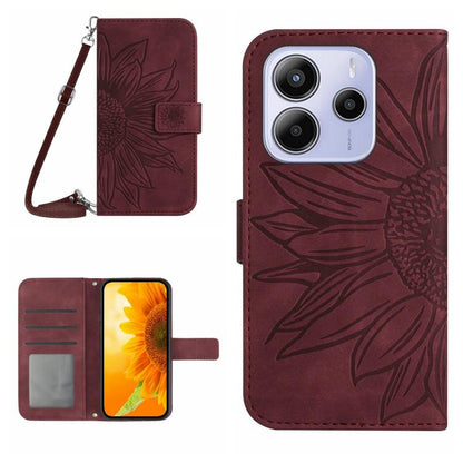 Skin Feel Sun Flower Embossed Flip Leather Phone Case with Lanyard, For Redmi 13x, For Redmi A5 4G 173.3mm, For Redmi A5 4G 171.7mm / Poco C71, For Redmi Note 14 4G 164.84mm EU Version, For Redmi Note 14 Pro 4G, For Redmi Note 14 4G 163.25mm           ...
