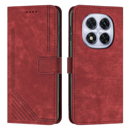 Skin Feel Stripe Pattern Leather Phone Case with Lanyard, For Redmi 15a 5G, For Redmi A7 Pro 4G 171mm, For Redmi Turbo 5 Max / Poco X8 Pro Max 5G, For Redmi Turbo 5 / Poco X8 Pro 5G, For Redmi Note 15 Pro+ 5G Global 163.3mm                             ...