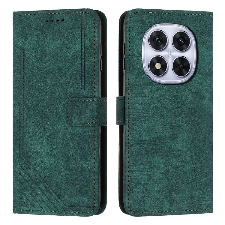 Skin Feel Stripe Pattern Leather Phone Case with Lanyard, For Redmi 15a 5G, For Redmi A7 Pro 4G 171mm, For Redmi Turbo 5 Max / Poco X8 Pro Max 5G, For Redmi Turbo 5 / Poco X8 Pro 5G, For Redmi Note 15 Pro+ 5G Global 163.3mm                             ...
