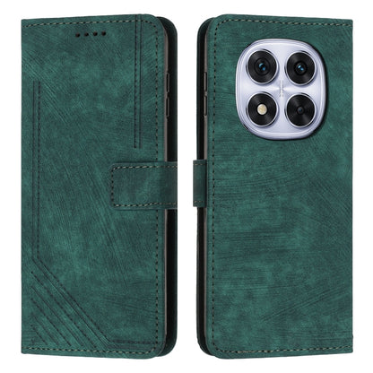Skin Feel Stripe Pattern Leather Phone Case with Lanyard, For Redmi 15a 5G, For Redmi A7 Pro 4G 171mm, For Redmi Turbo 5 Max / Poco X8 Pro Max 5G, For Redmi Turbo 5 / Poco X8 Pro 5G, For Redmi Note 15 Pro+ 5G Global 163.3mm                             ...