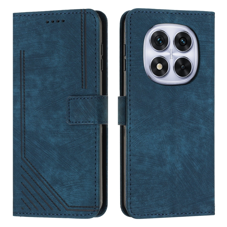 Skin Feel Stripe Pattern Leather Phone Case with Lanyard, For Redmi 15a 5G, For Redmi A7 Pro 4G 171mm, For Redmi Turbo 5 Max / Poco X8 Pro Max 5G, For Redmi Turbo 5 / Poco X8 Pro 5G, For Redmi Note 15 Pro+ 5G Global 163.3mm                             ...