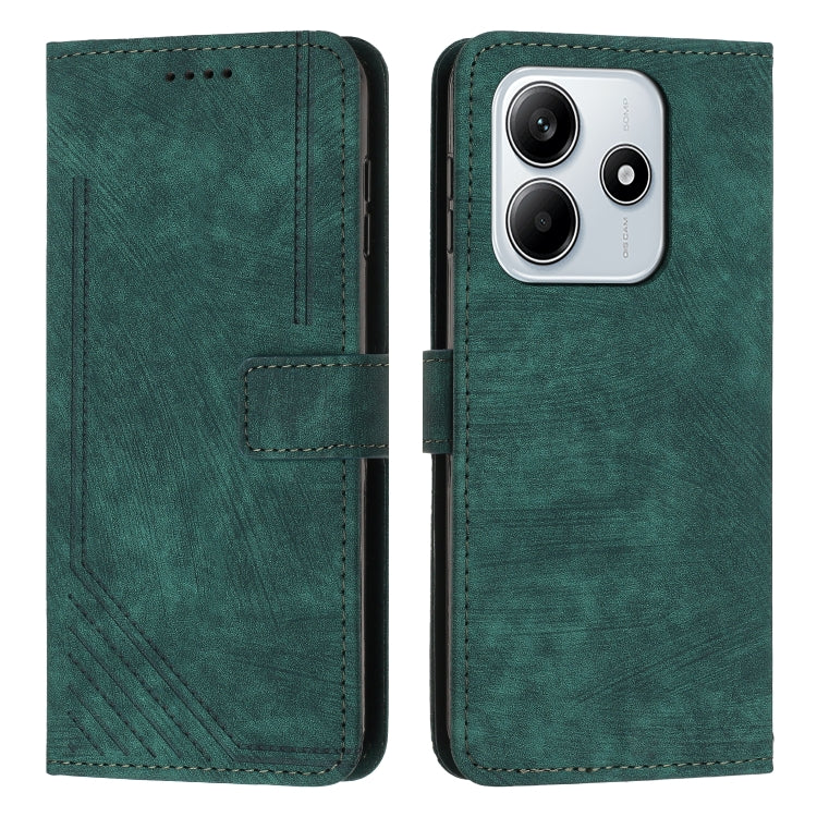 Skin Feel Stripe Pattern Leather Phone Case with Lanyard, For Redmi Turbo 4 / Xiaomi Poco X7 Pro, For Redmi K80 / K80 Pro, For Redmi Note 14 4G 163.25mm, For Redmi Note 14 5G Global