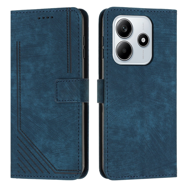 Skin Feel Stripe Pattern Leather Phone Case with Lanyard, For Redmi Turbo 4 / Xiaomi Poco X7 Pro, For Redmi K80 / K80 Pro, For Redmi Note 14 4G 163.25mm, For Redmi Note 14 5G Global