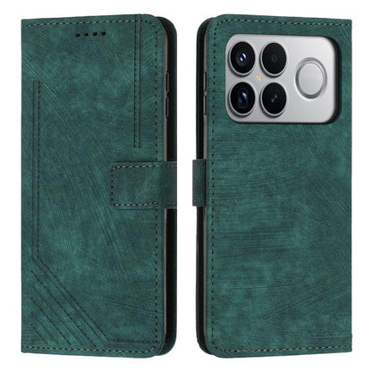 Skin Feel Stripe Pattern Leather Phone Case with Lanyard, For Redmi 15a 5G, For Redmi A7 Pro 4G 171mm, For Redmi Turbo 5 Max / Poco X8 Pro Max 5G, For Redmi Turbo 5 / Poco X8 Pro 5G, For Redmi Note 15 Pro+ 5G Global 163.3mm                             ...