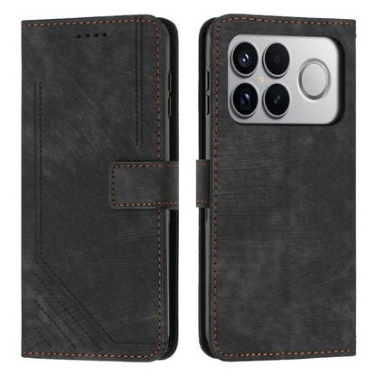 Skin Feel Stripe Pattern Leather Phone Case with Lanyard, For Redmi 15a 5G, For Redmi A7 Pro 4G 171mm, For Redmi Turbo 5 Max / Poco X8 Pro Max 5G, For Redmi Turbo 5 / Poco X8 Pro 5G, For Redmi Note 15 Pro+ 5G Global 163.3mm                             ...