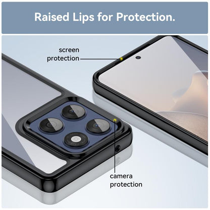 Colorful Series Acrylic Hybrid TPU Phone Case, For Motorola Edge 60 Fusion, For Motorola Moto G Stylus 5G 2025, For Motorola Moto E15, For Motorola Moto G05, For Motorola Moto G15