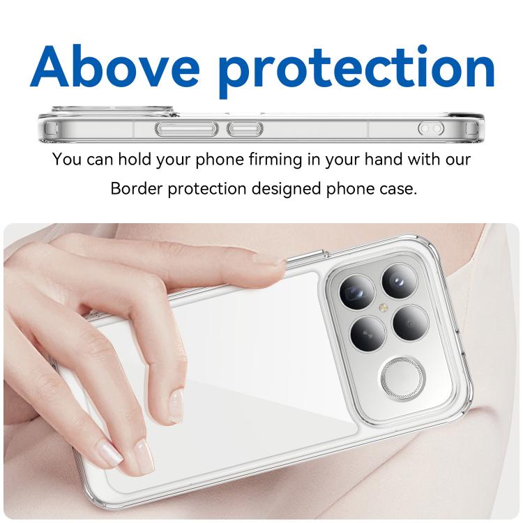 WANLONFENG Electroplated Buttons TPU Acrylic Phone Case with Screen Protector, For Redmi K90 Pro Max / Poco F8 Ultra, For Redmi K90 / Poco F8 Pro, For Redmi 15 5G / 4G EU 171mm, For Redmi 15C 5G / 4G EU 173mm, For Redmi 15 5G Global 169.5mm            ...