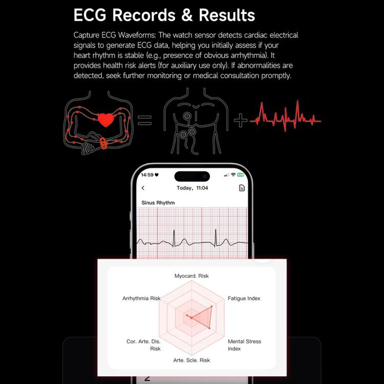 E900 Screenless BT Smart Bracelet Woven Strap, Support ECG Heart Health Analysis / Health Monitoring