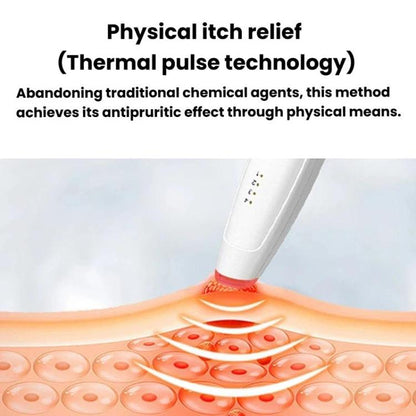 SB-1316 Infrared Pulse Anti-Itch Pen Outdoor Portable Itch Relief Stic, SB-1316
