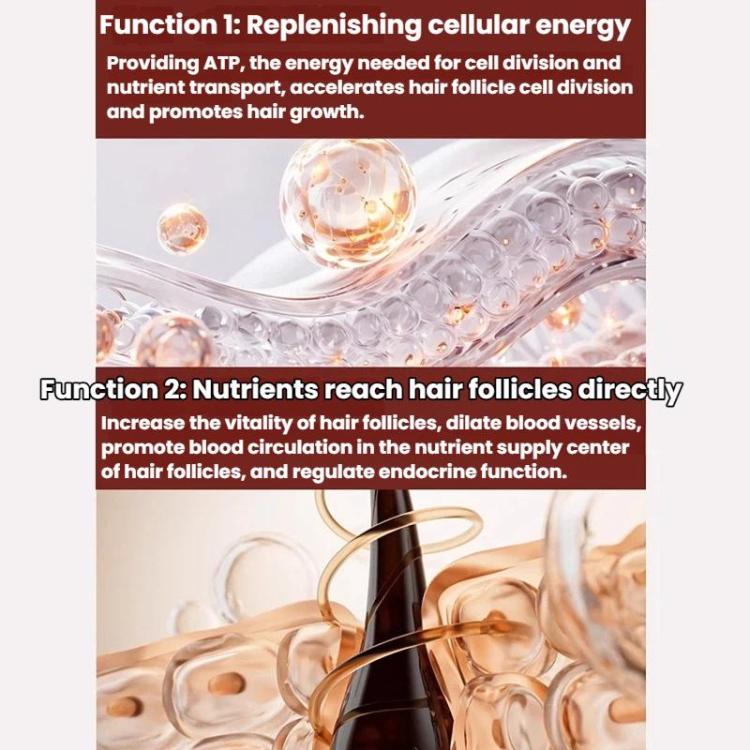 SF-001 660nm Silicone Wireless Remote-Controlled Red Light Hair Growth Device Portable Anti-Hair Loss Hair Care Cap